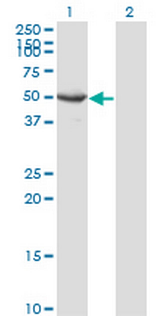 SEPT10 Antibody in Western Blot (WB)