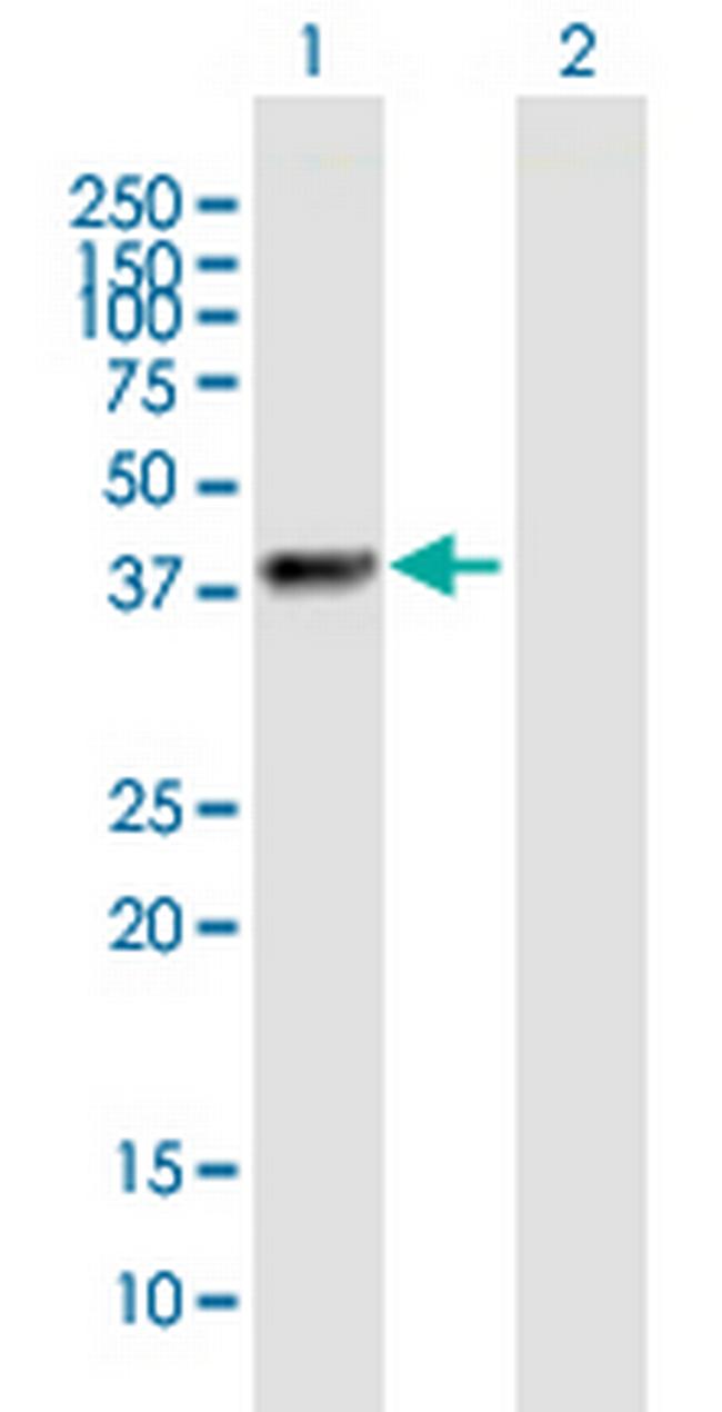 ZNF385B Antibody in Western Blot (WB)