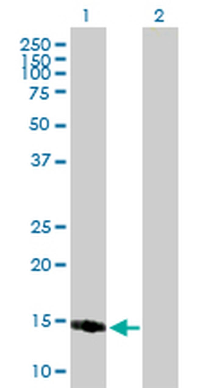 PPP1R1C Antibody in Western Blot (WB)