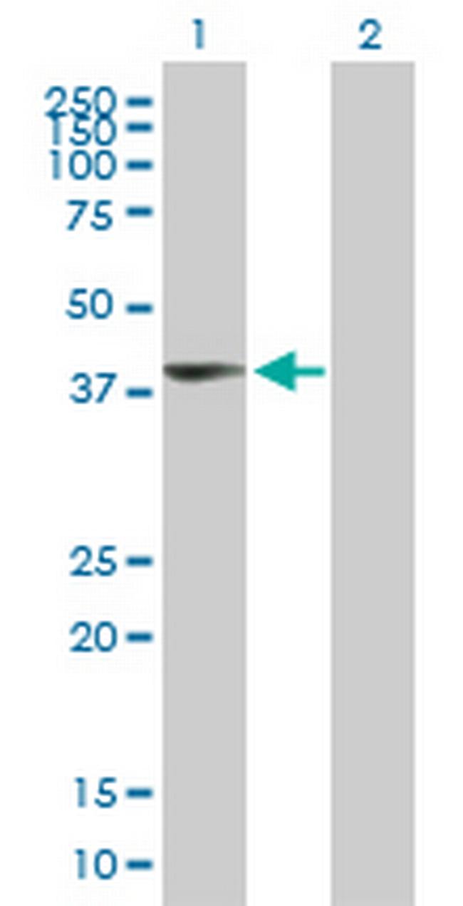 UPP2 Antibody in Western Blot (WB)