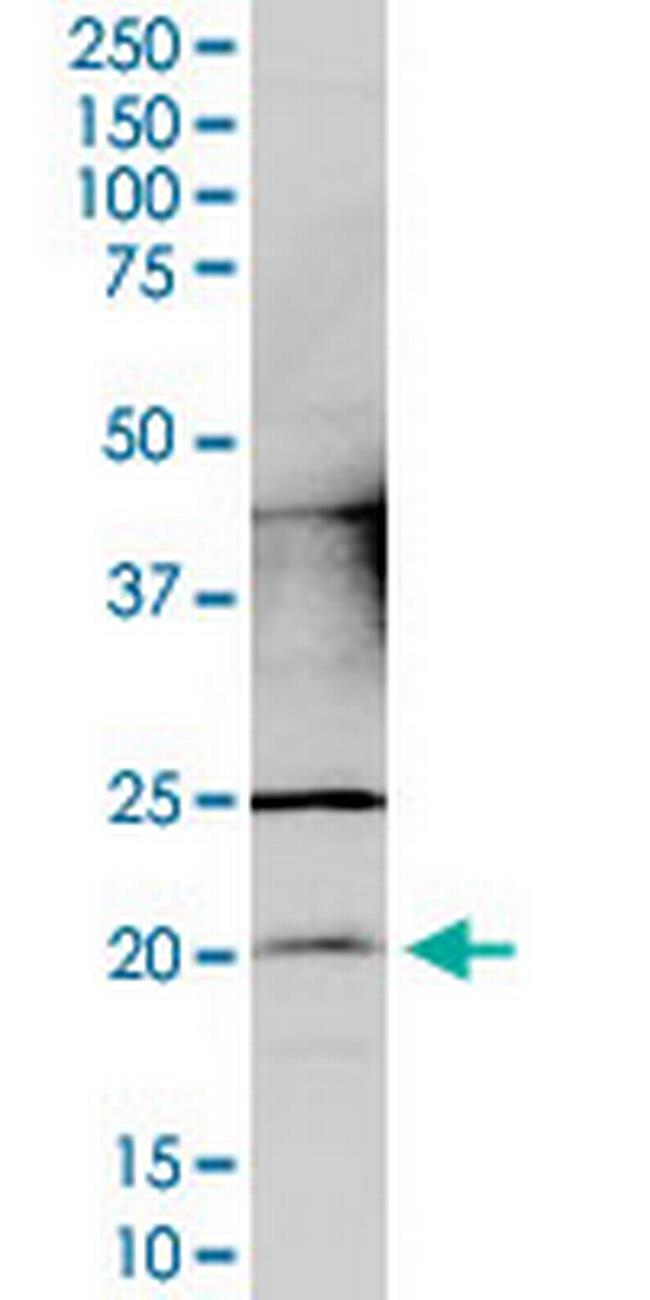 CCDC12 Antibody in Western Blot (WB)