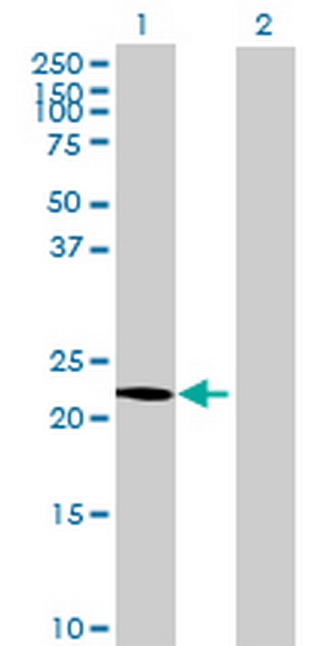 ROPN1B Antibody in Western Blot (WB)