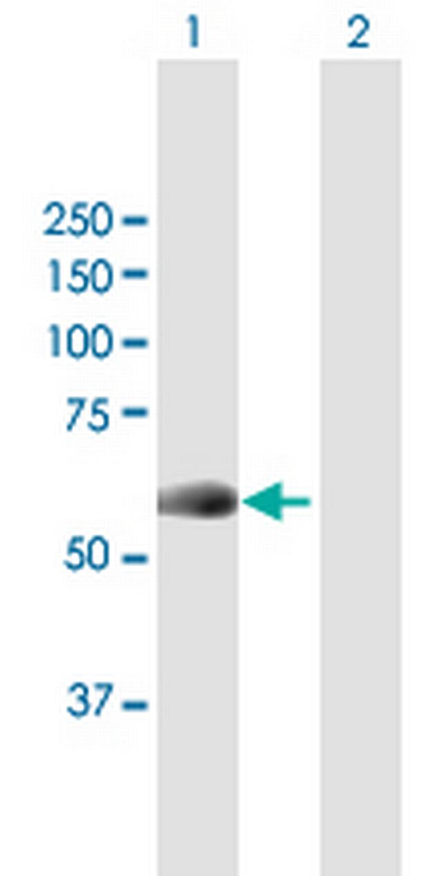 NEK10 Antibody in Western Blot (WB)