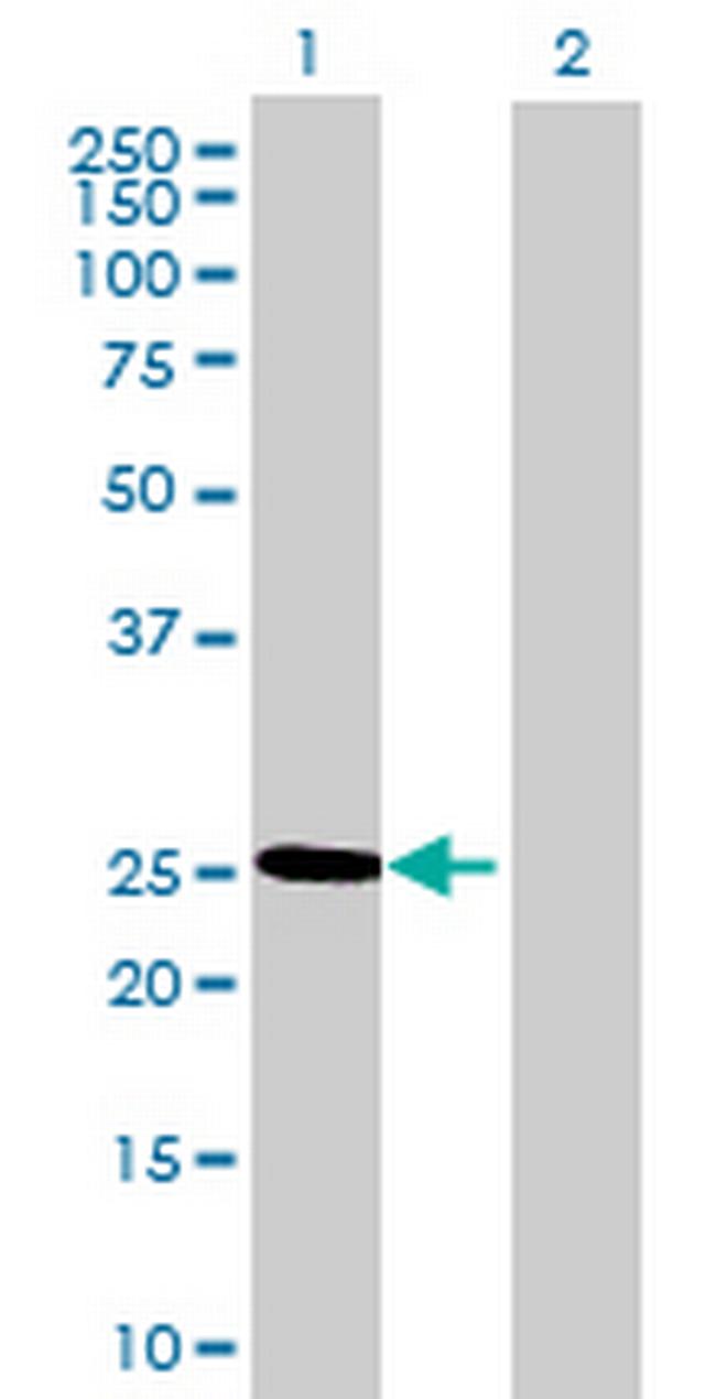 THAP6 Antibody in Western Blot (WB)