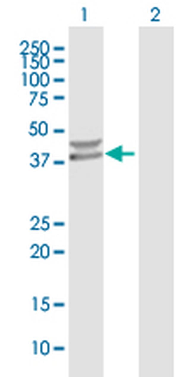 PPM1K Antibody in Western Blot (WB)