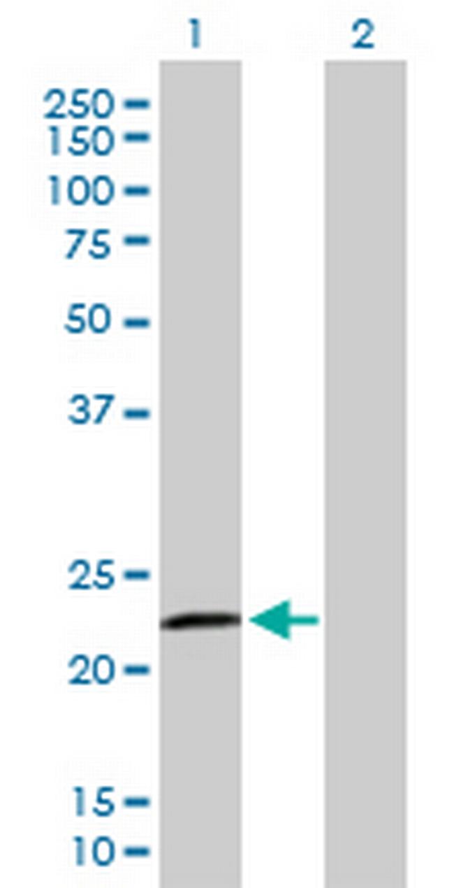 RASGEF1B Antibody in Western Blot (WB)