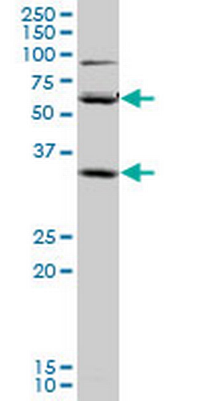 SLC36A2 Antibody in Western Blot (WB)