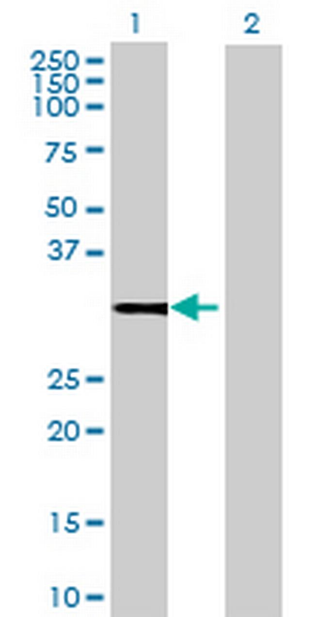 ZMAT2 Antibody in Western Blot (WB)