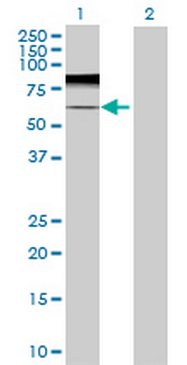 DKFZp313G1735 Antibody in Western Blot (WB)