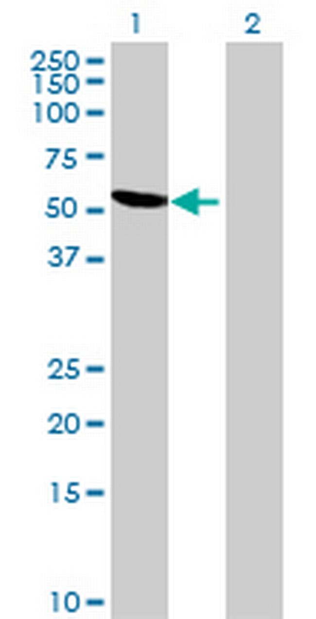 MGC39633 Antibody in Western Blot (WB)