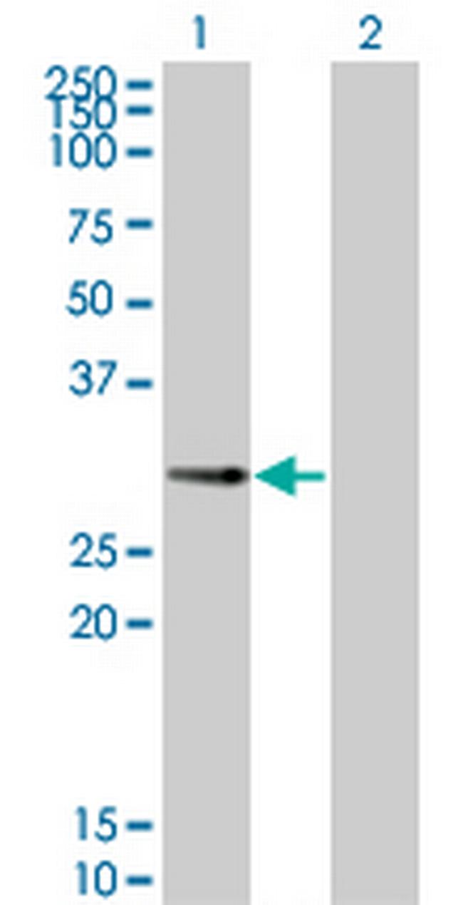 PPP1R2P3 Antibody in Western Blot (WB)