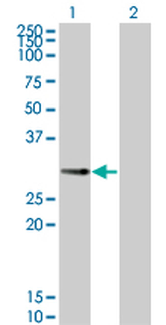 PPP1R2P3 Antibody in Western Blot (WB)