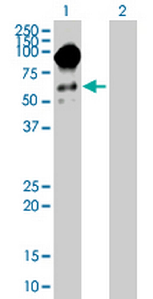 FAM71B Antibody in Western Blot (WB)