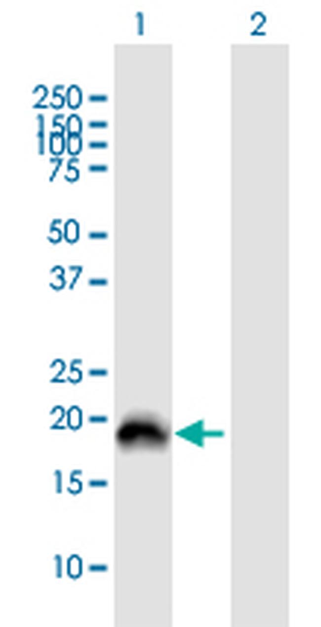 PRELID2 Antibody in Western Blot (WB)