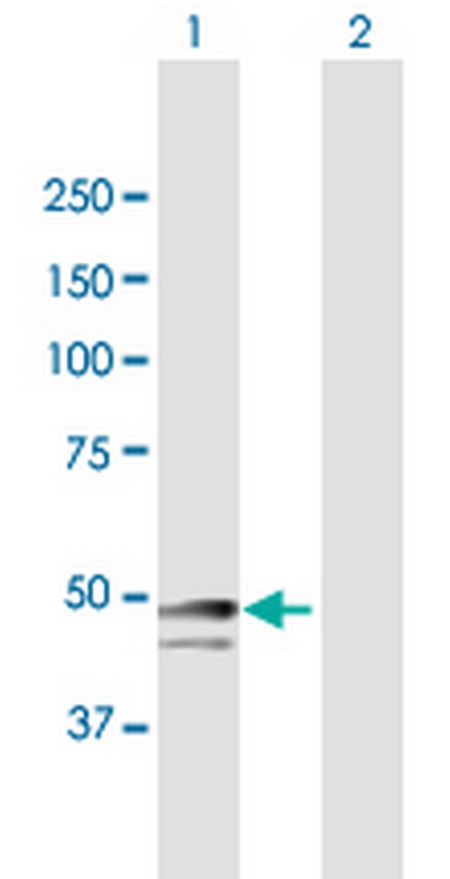 SNRNP48 Antibody in Western Blot (WB)