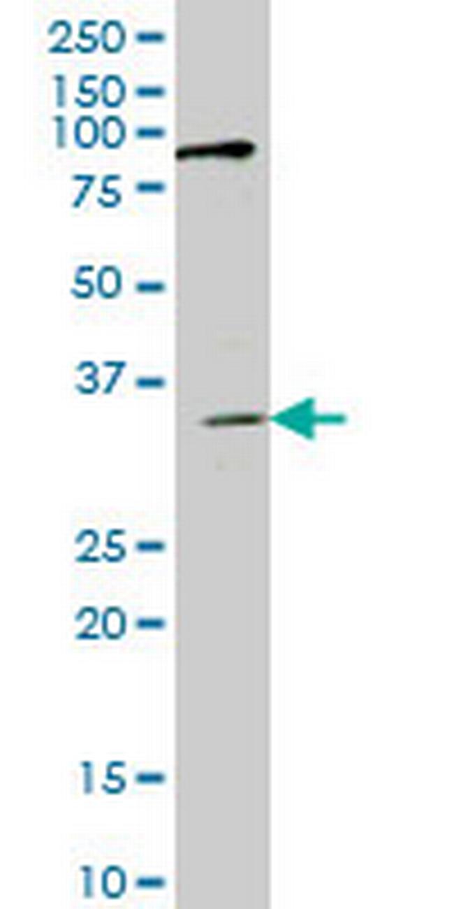 IBRDC1 Antibody in Western Blot (WB)