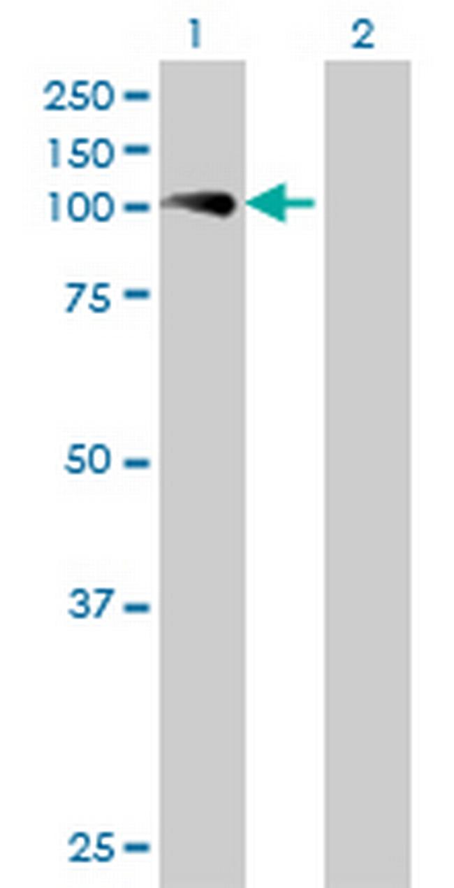 FLJ35834 Antibody in Western Blot (WB)
