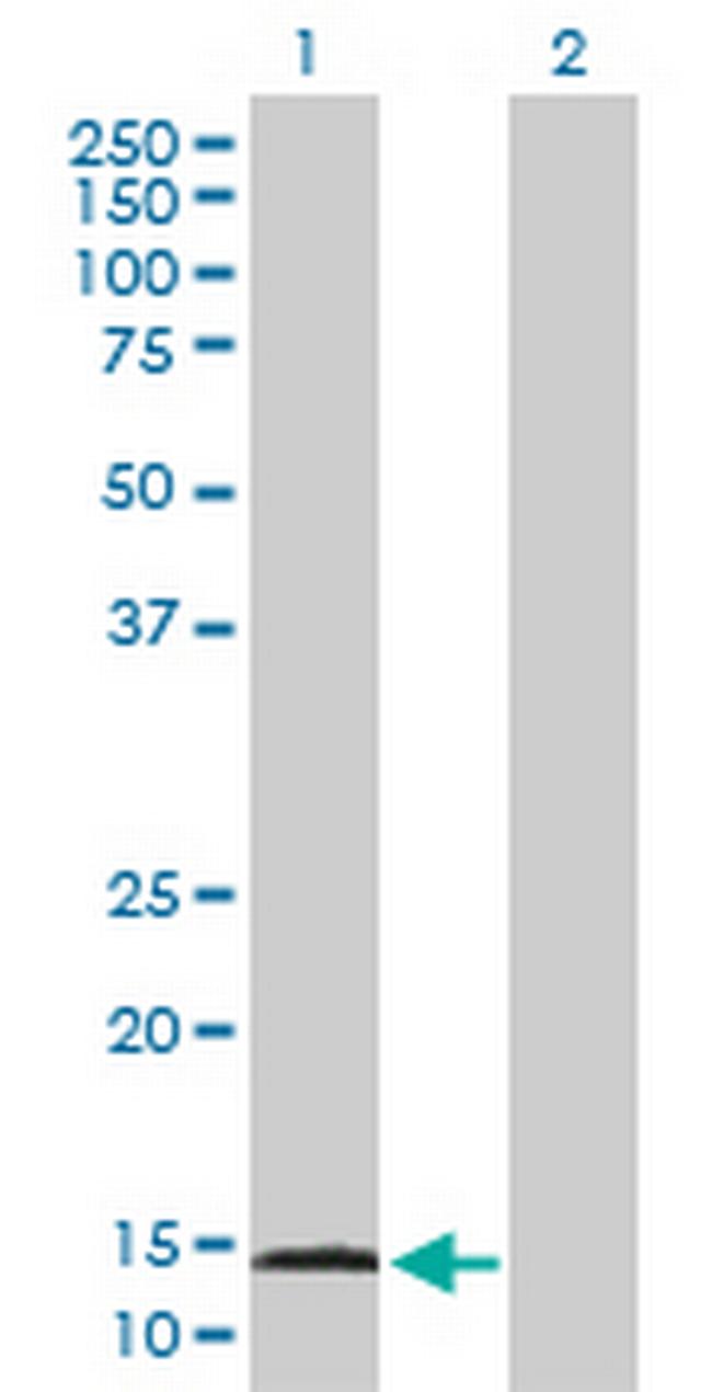 AGR3 Antibody in Western Blot (WB)