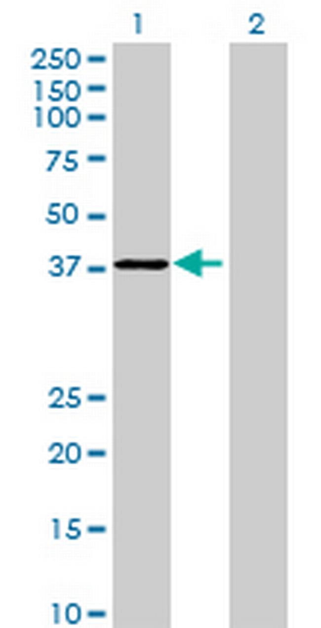 RG9MTD3 Antibody in Western Blot (WB)