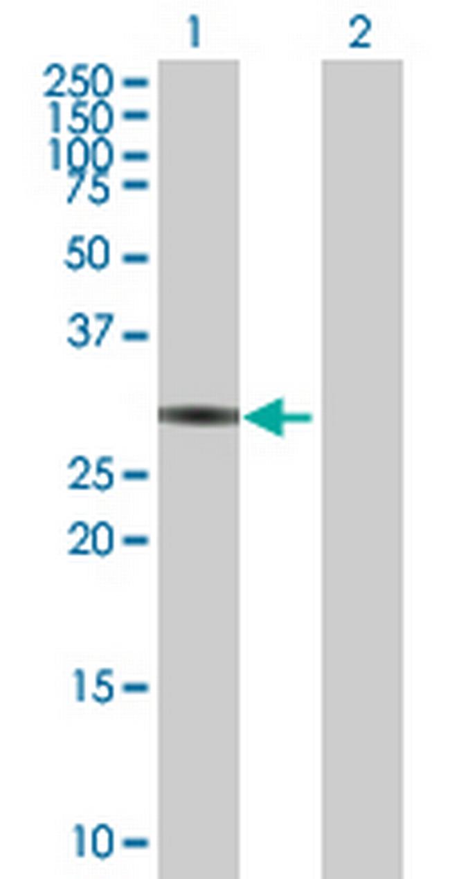 ZNF483 Antibody in Western Blot (WB)