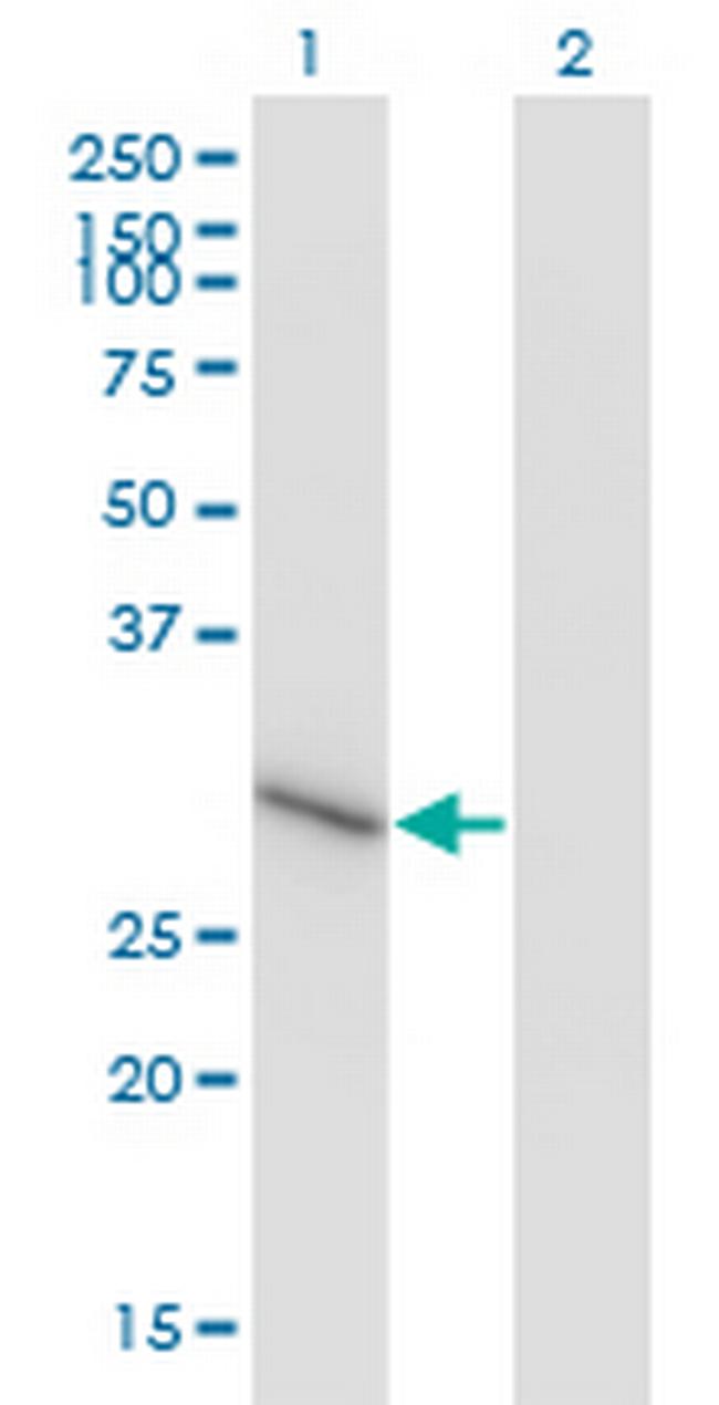 ZNF483 Antibody in Western Blot (WB)