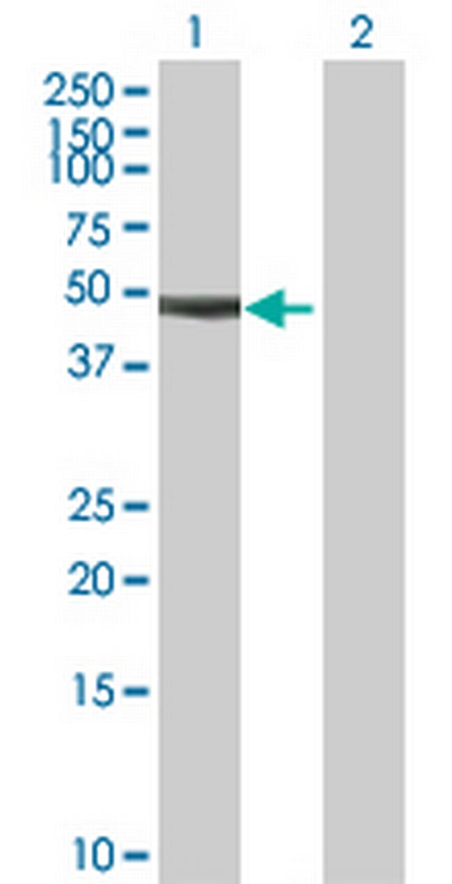 RIBC1 Antibody in Western Blot (WB)