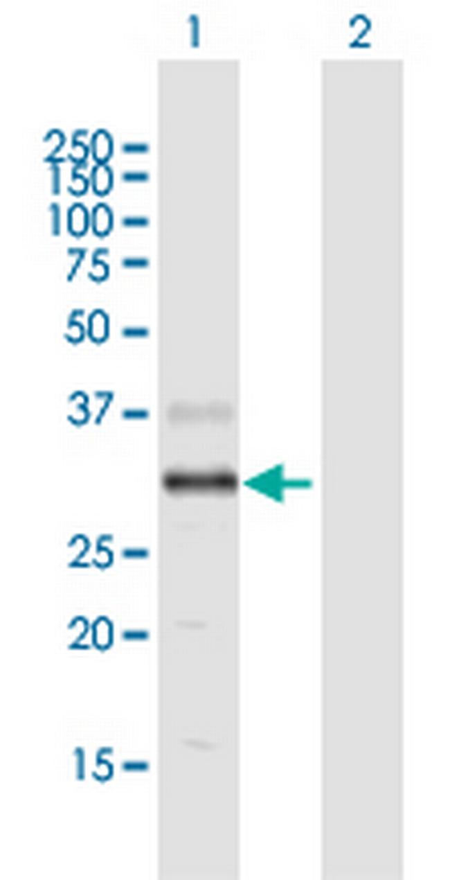 DGAT2L4 Antibody in Western Blot (WB)