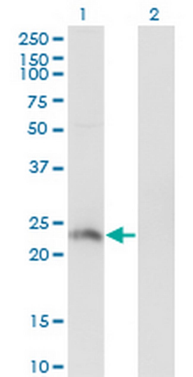 HSFY2 Antibody in Western Blot (WB)