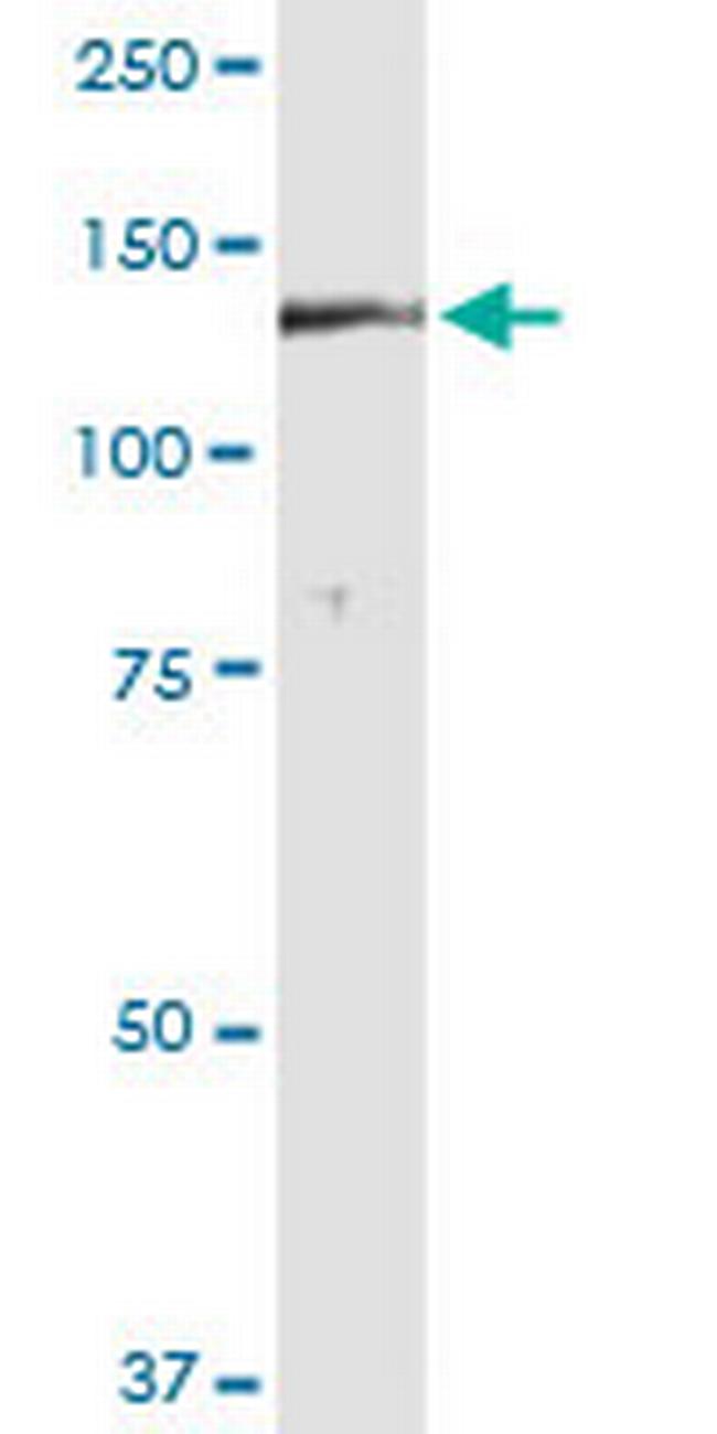 DGKH Antibody in Western Blot (WB)