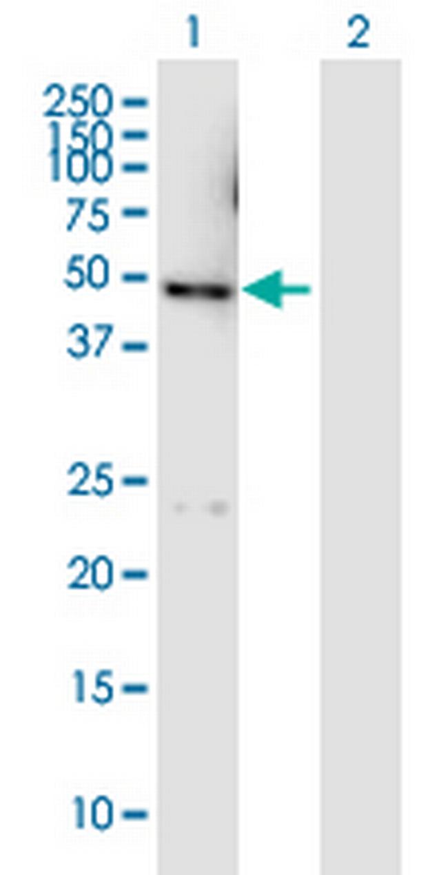 DYX1C1 Antibody in Western Blot (WB)