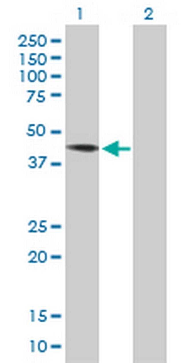 DYX1C1 Antibody in Western Blot (WB)