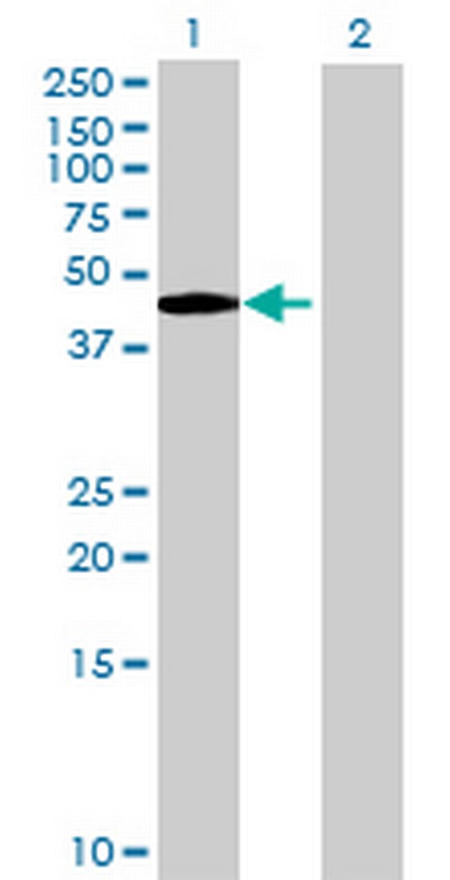 EXDL1 Antibody in Western Blot (WB)