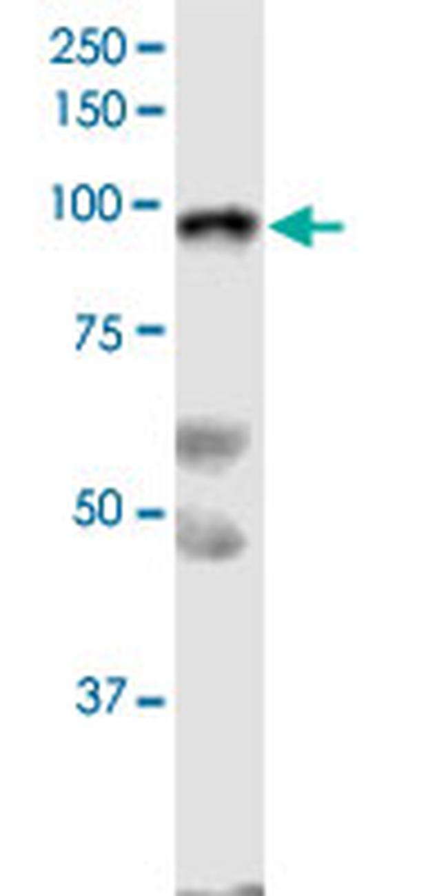 SLFN5 Antibody in Western Blot (WB)