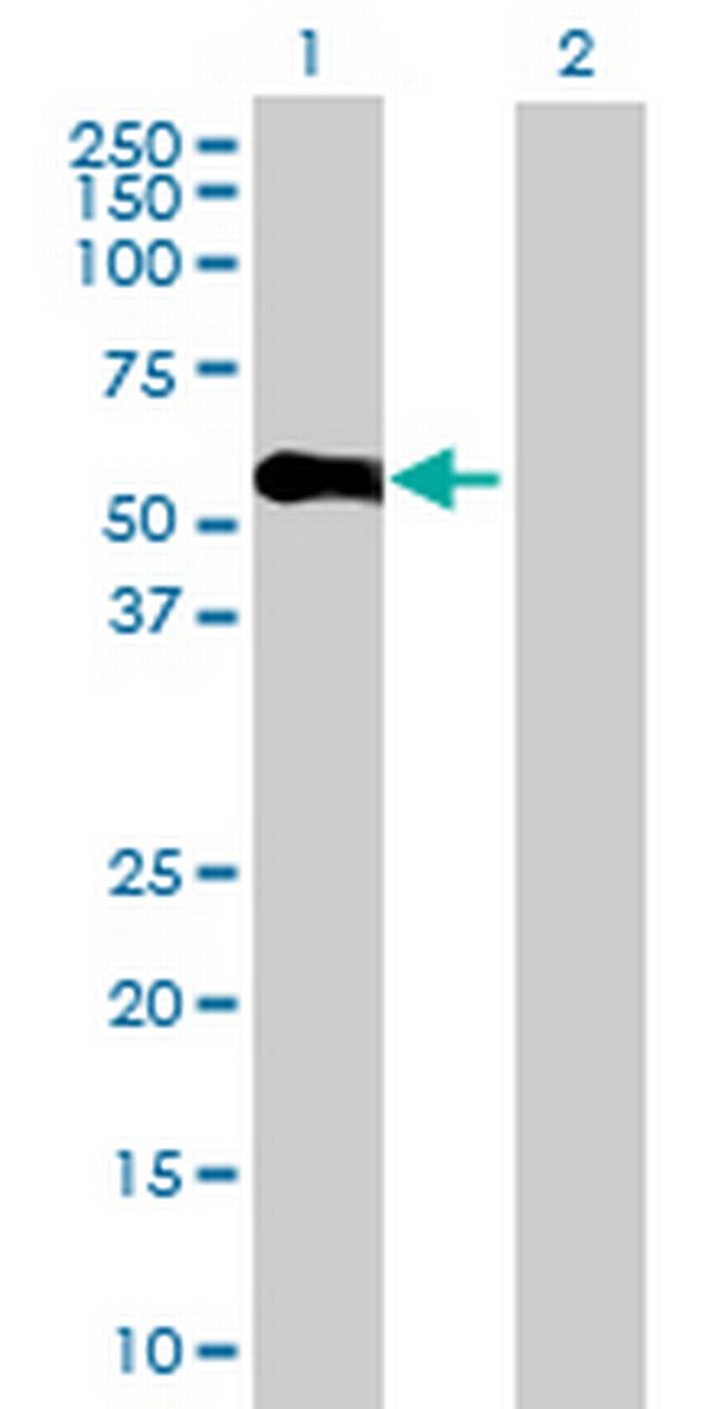 KRT25D Antibody in Western Blot (WB)