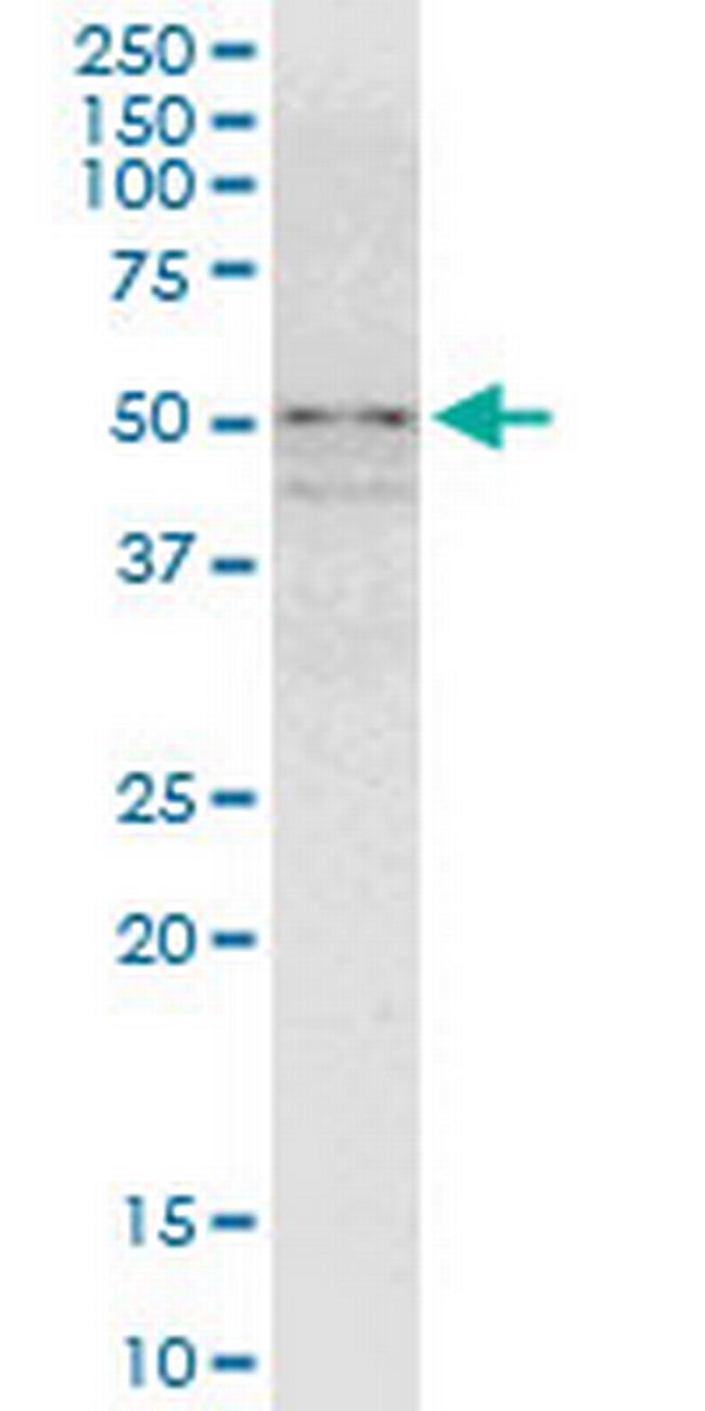 ZNF296 Antibody in Western Blot (WB)