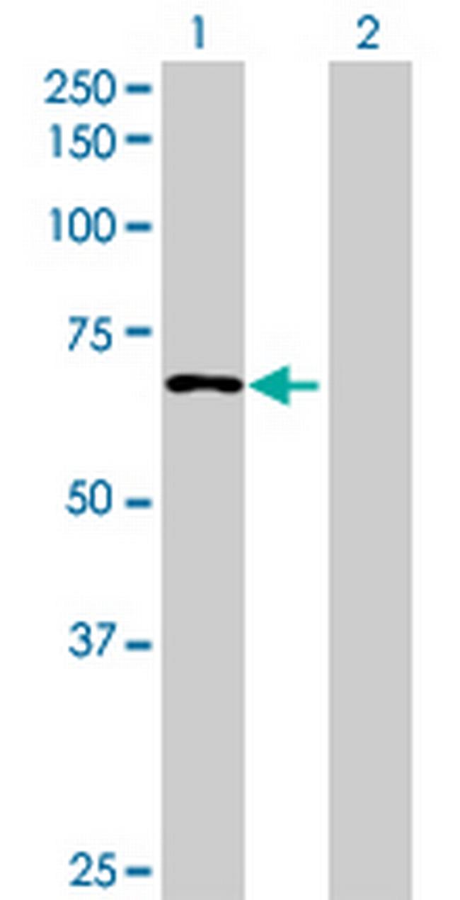 FLJ90396 Antibody in Western Blot (WB)