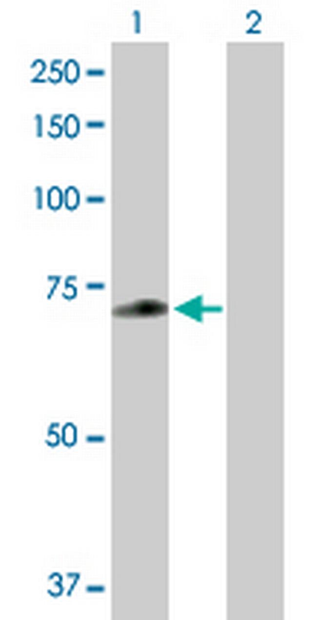 ZNF567 Antibody in Western Blot (WB)