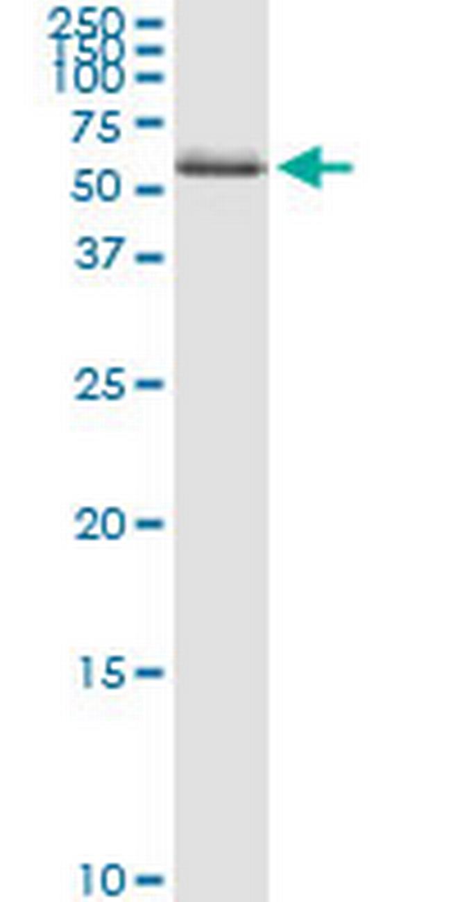 ZNF100 Antibody in Western Blot (WB)