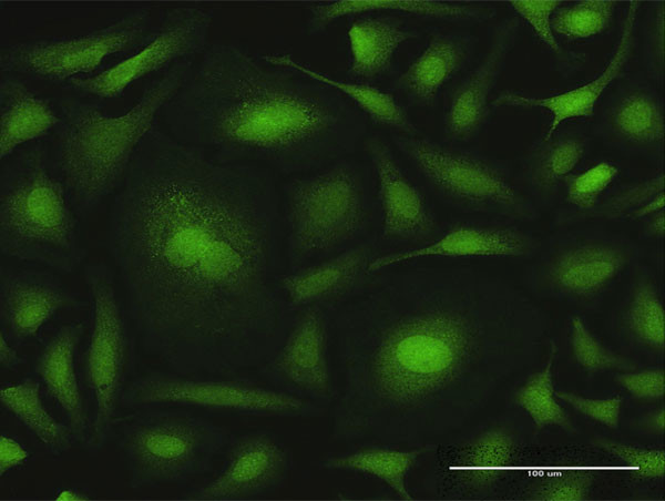 CALML6 Antibody in Immunocytochemistry (ICC/IF)