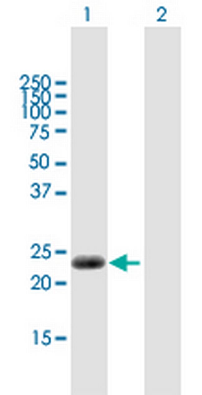 CABP7 Antibody in Western Blot (WB)