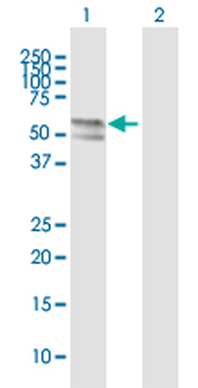 TMPRSS6 Antibody in Western Blot (WB)