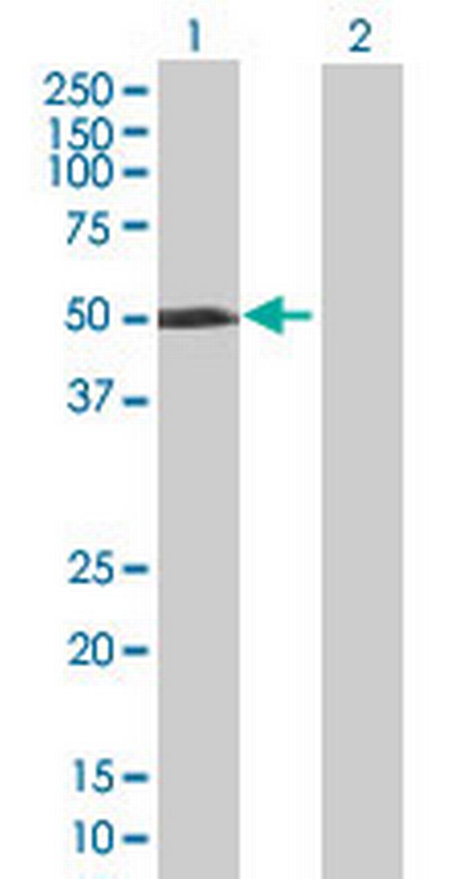 MGC35154 Antibody in Western Blot (WB)