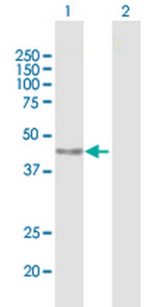 PARP15 Antibody in Western Blot (WB)