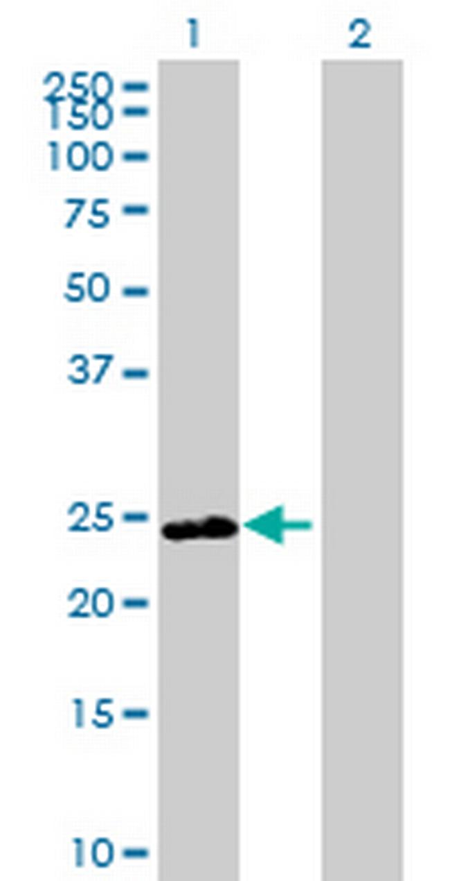 DNAJB8 Antibody in Western Blot (WB)