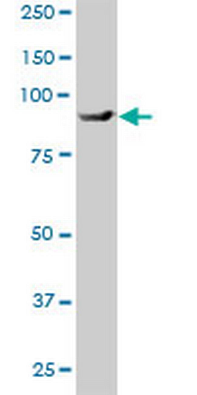 BBS12 Antibody in Western Blot (WB)