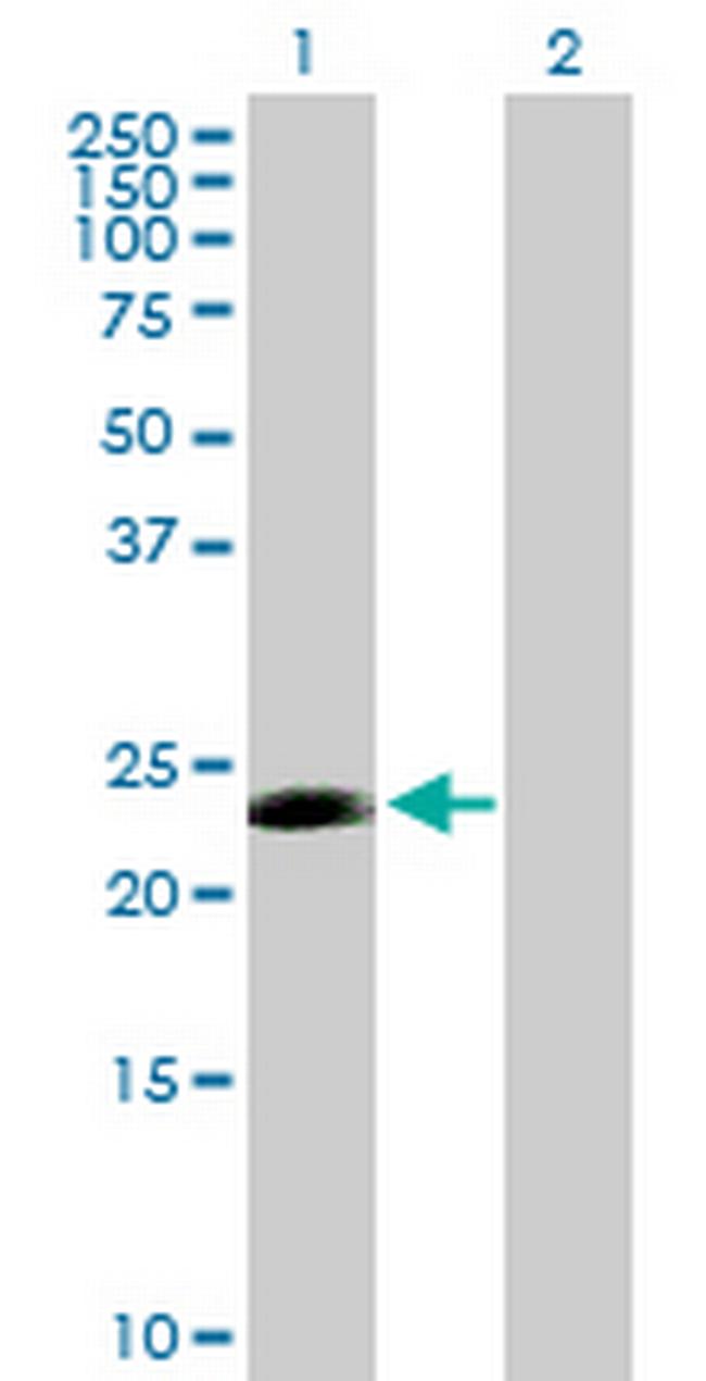 CDC20B Antibody in Western Blot (WB)