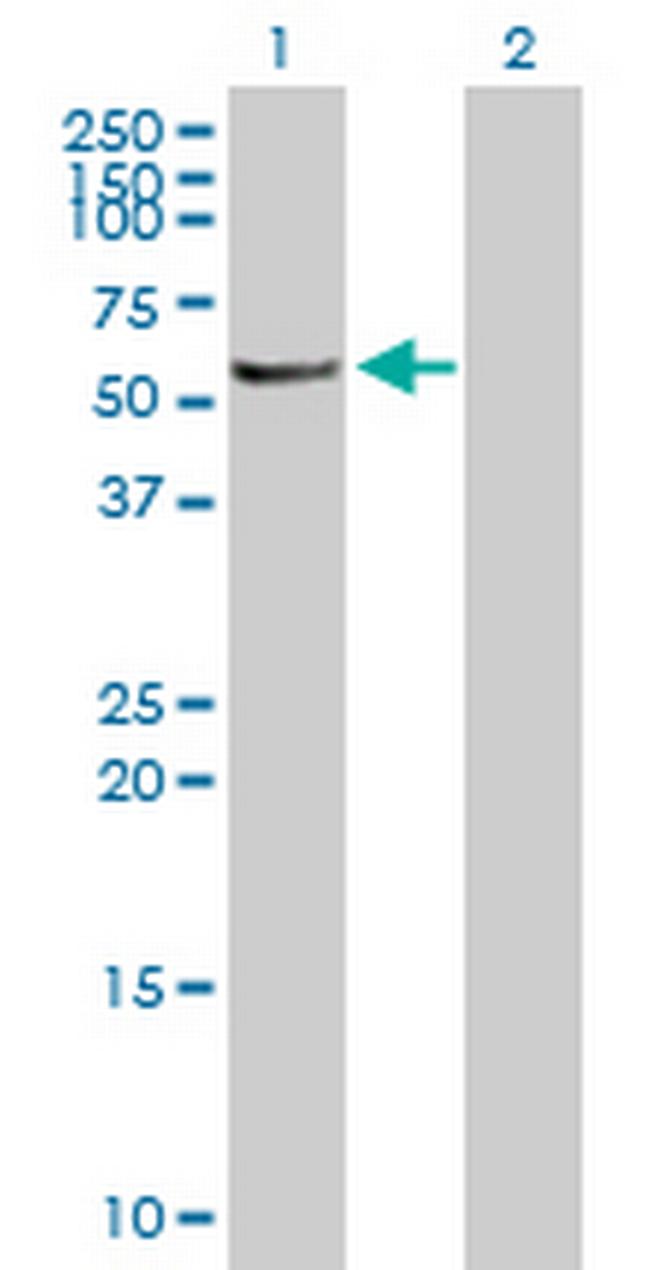 MGC42105 Antibody in Western Blot (WB)