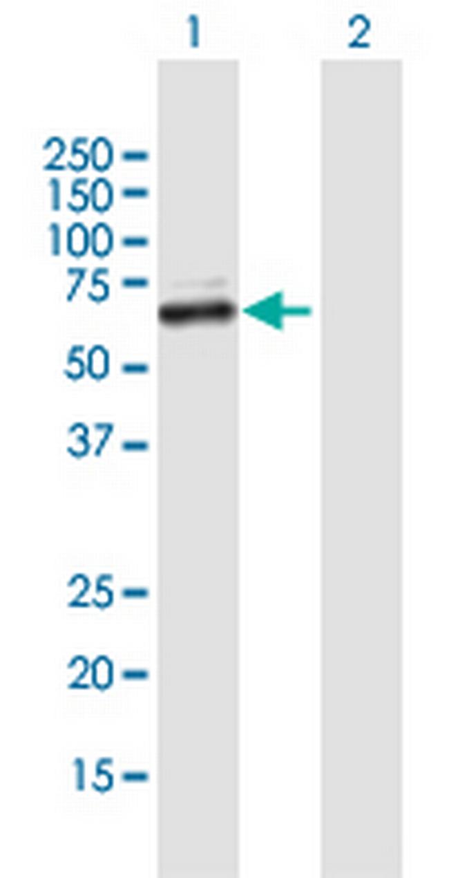 ZNF92 Antibody in Western Blot (WB)