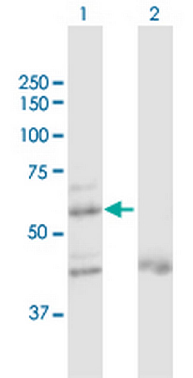 ZNF92 Antibody in Western Blot (WB)