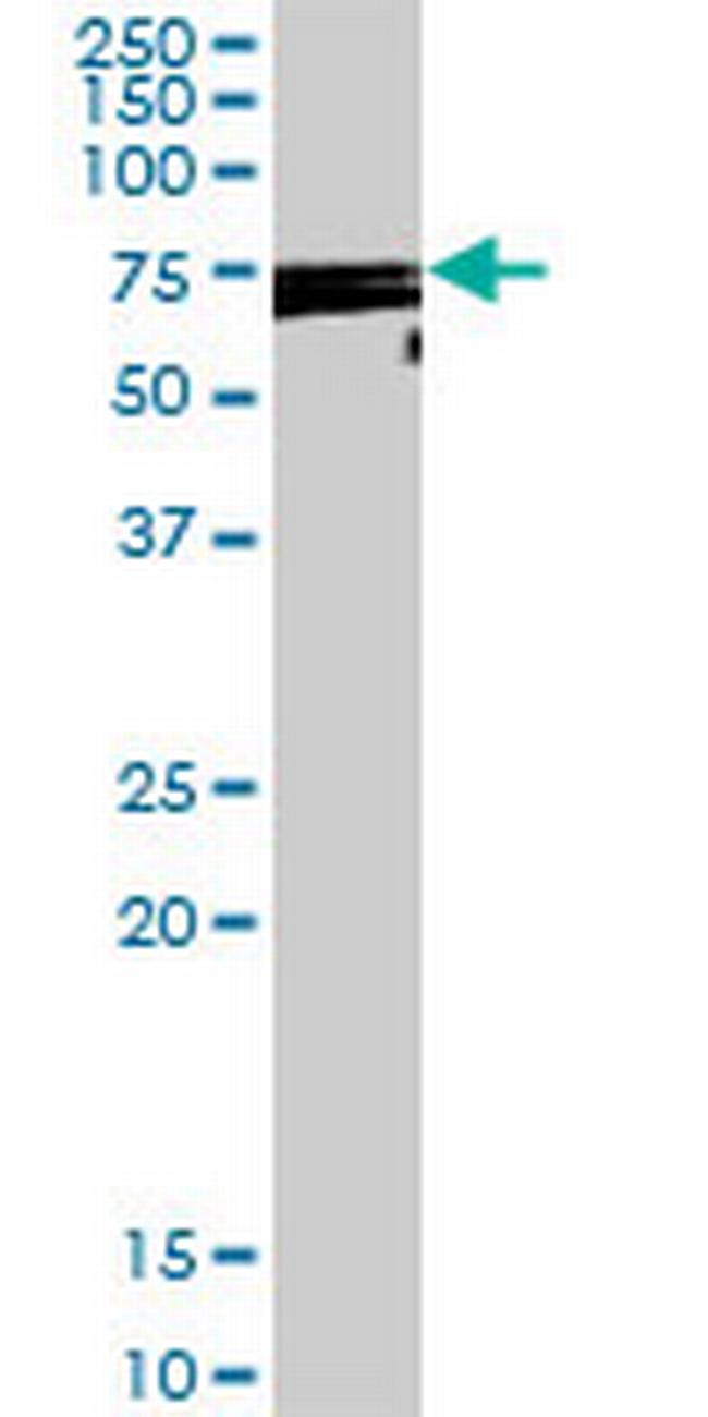 DDX53 Antibody in Western Blot (WB)